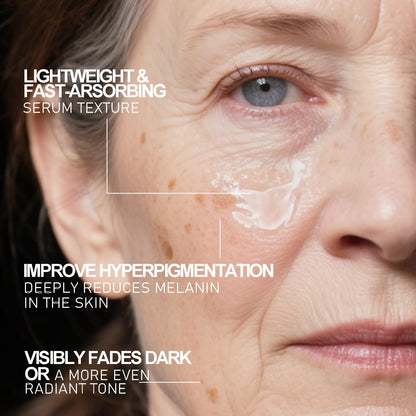 Aobenz Dark Spot Remover